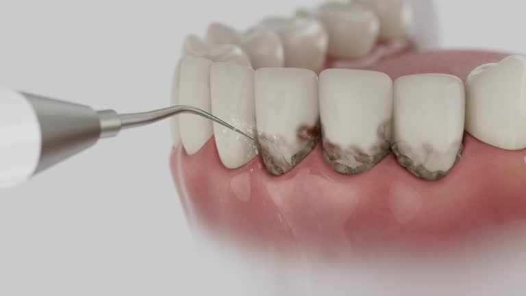 Reliable Dental Implants contractor in Sutton, NE by Smile Center Dentistry